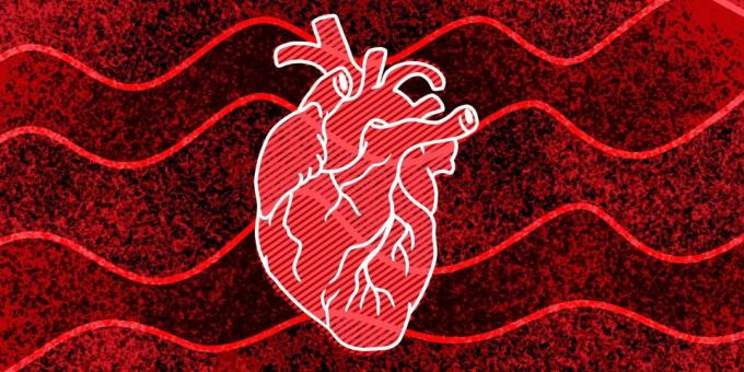 11 pazīmes, ka jums var notikt sirds apstāšanās