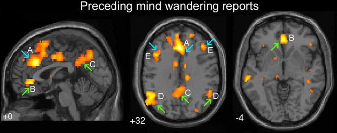 Zaļās bultiņas norāda jomas smadzeņu, kas atbild par "automātisko uzvedību". Blue arrow - par "izpilddirektors" ir daļa no smadzenēm. A - muguras cingulate, B - ventralanya cingulate, C - precuneus smadzeņu puslodes, D - divpusējs temporoparietal Junction, E - dorsolateral prefrontal garozā