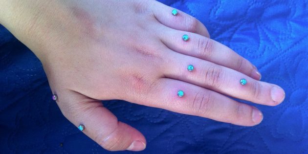 Transdermālie implants uz pirkstiem