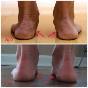 Kā palaist minimālisma kurpes mainīt kājām