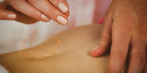 Akupunktūra: Kas ir vērts zināt par ārstēšanas plānas adatas
