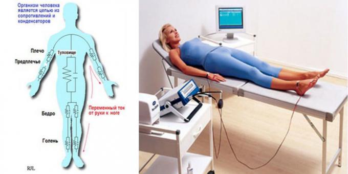 Ķermeņa bioimpedance analīze ierīce "MEDASS"